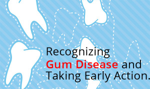 Recognizing-Gum-Disease.jpg